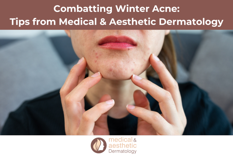 Combatting Winter Acne Tips from Medical & Aesthetic Dermatology