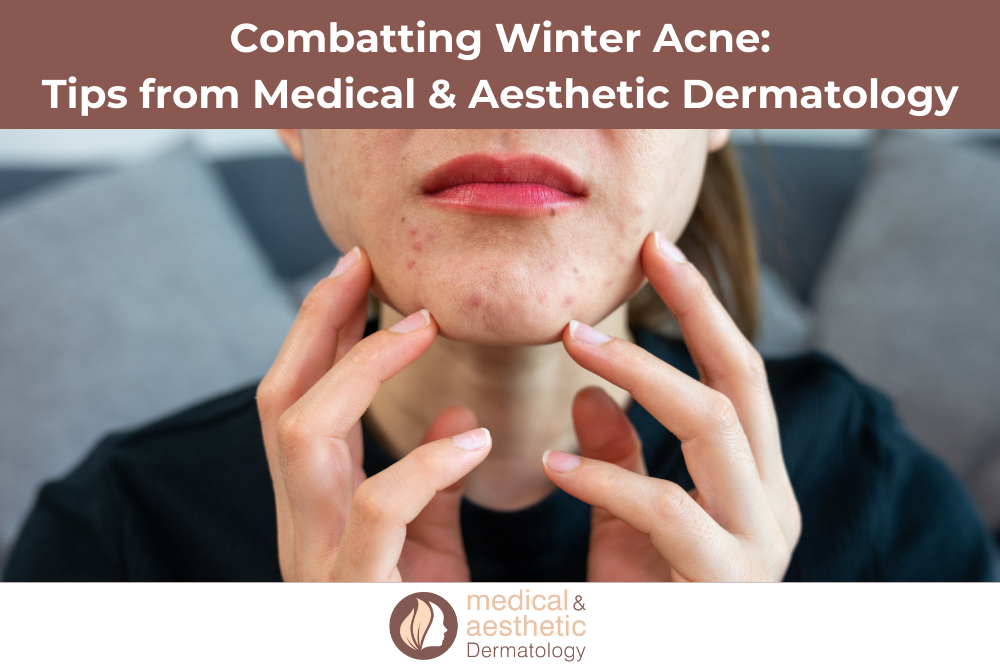 Combatting Winter Acne Tips from Medical & Aesthetic Dermatology